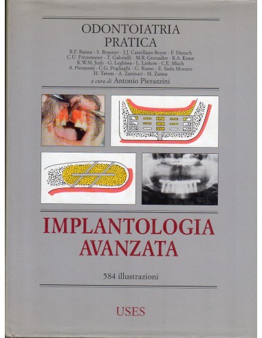 Implantologia avanzata odontoiatria...
