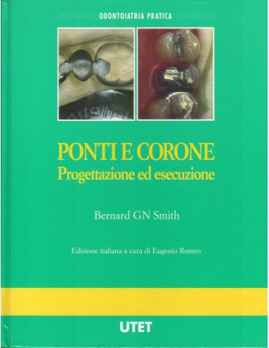 Ponti e Corone progettazione ed...