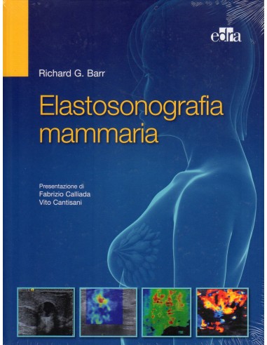 Elastosonografia mammaria 1/e 2017