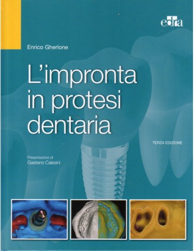 Impronta in protesi dentale 3/e 2017...