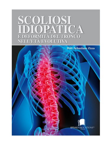 Scoliosi Idiopatica e deformità del...