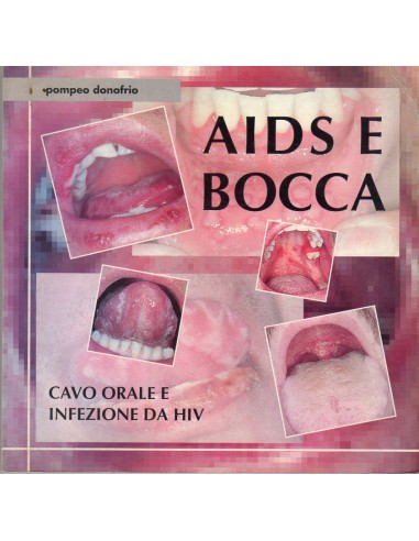 Aids e bocca Cavo orale e infezioni...