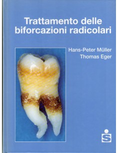 Trattamento delle...