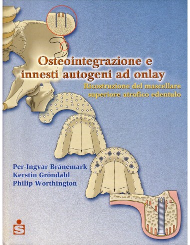 Osteointegrazione e innesti autogeni...