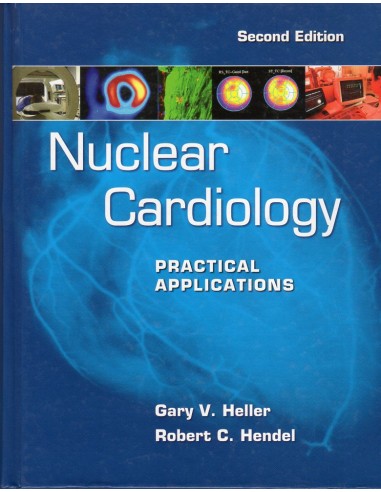 Nuclear cardiology Practical Apllication