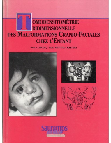 Tomodensitometrie tridimensionnelle...