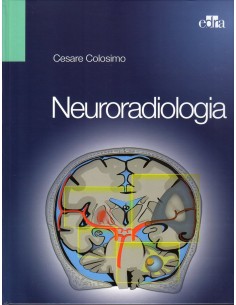 NeuroRadiologia 1/e 2013