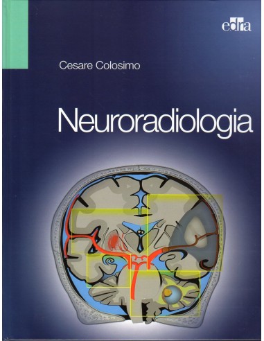NeuroRadiologia 1/e 2013