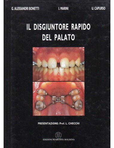 Disgiuntore rapido del palato