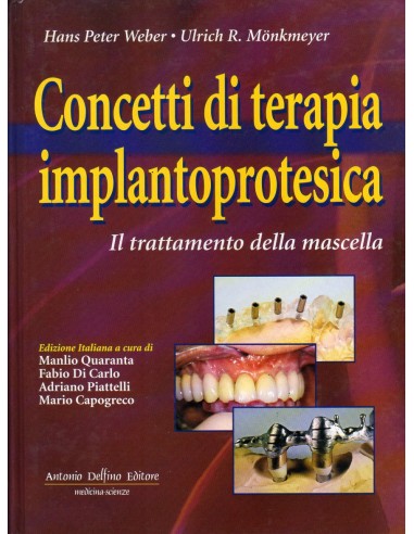 Concetti di terapia implantoprotesica...