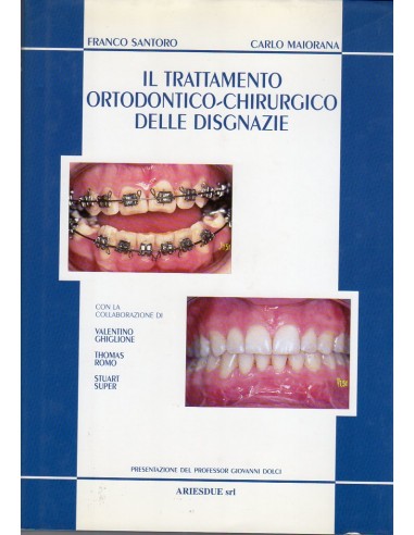 Trattamento ortodontico chirurgico...