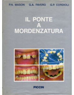 Ponte a mordenzatura (IL)