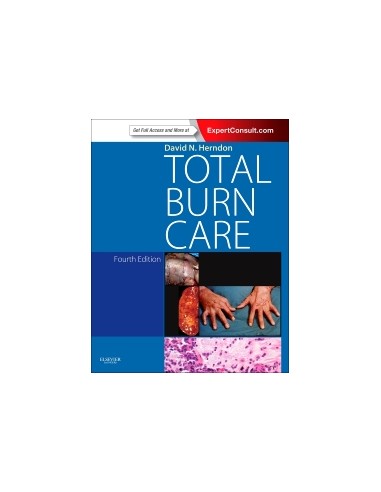 Total Burn Care 4/e 2012