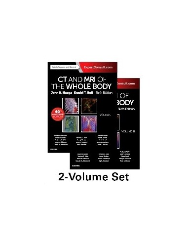 CT and MRI of the Whole Body 6/e 2017...
