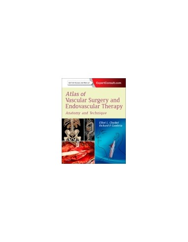Atlas of Vascular Surgery and...