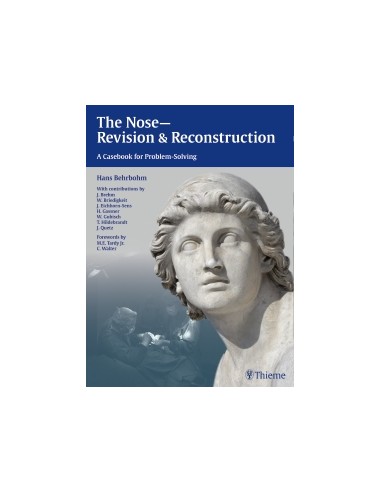 Nose Revision and Reconstruction A...