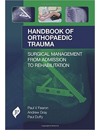 Handbook of Orthopaedic Trauma 1/e 2017