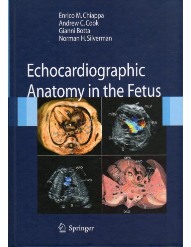 Echocardiographic Anatomy in the...