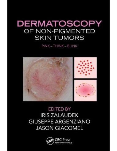Dermatoscopy of Non-Pigmented Skin...