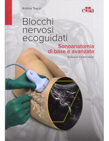 Blocchi nervosi ecoguidati...