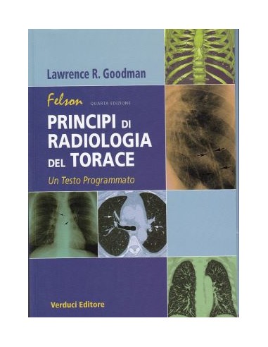 Felson Principi di Radiologia del...