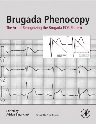 Brugada Phenocopy  The Art of...
