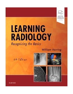 Learning Radiology...