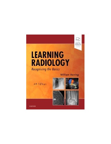 Learning Radiology Recognizing the...