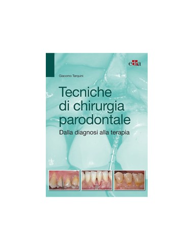 Tecniche di chirurgia parodontale...