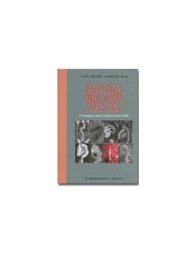 Patologia dell'Aorta Toracica...