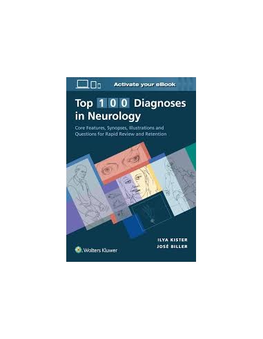 Top 100 Diagnoses in Neurology 1/e 2021