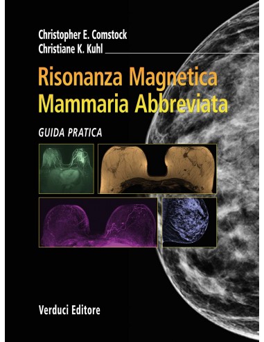 Risonanza Magnetica Mammaria...