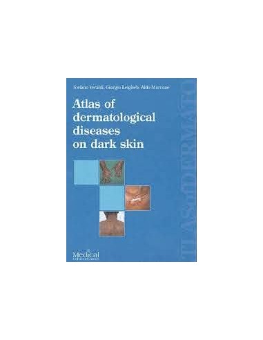 Atlas of Dermatological Disease on...