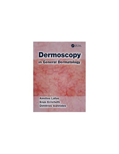 Dermoscopy in General Dermatology 1/e...