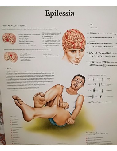 Epilessia Tavola didattica vr4626