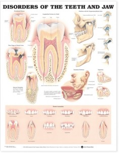 Disorders of The Teeth And...