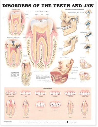 Disorders of The Teeth And Jaw...