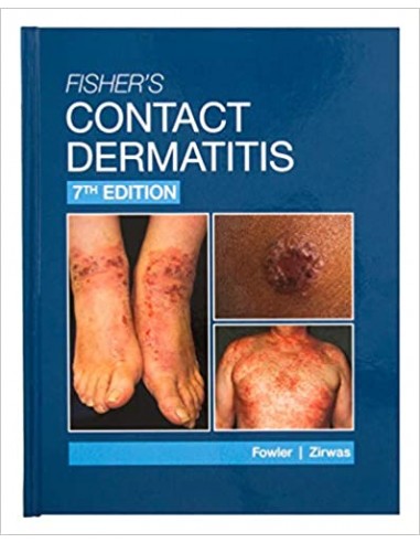 Contact dermatitis 7/e 2019