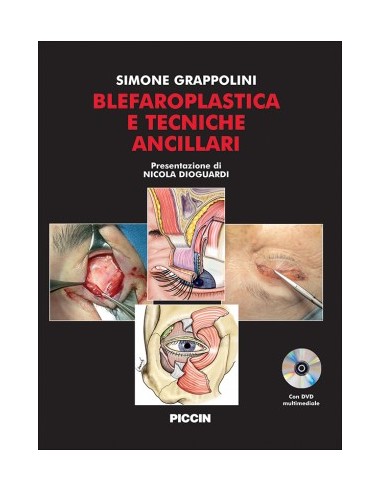 Blefaroplastica e Tecniche Ancillari...