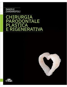 Chirurgia parodontale...
