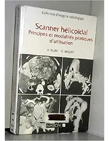 Scanner helicoidal principles et modalites pratiques d'utilisation
