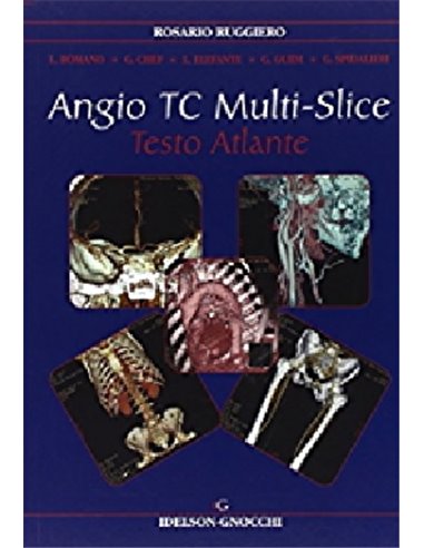 Angio TC Multi Slice testo atlante