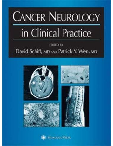 Cancer Neurology in clinical practice