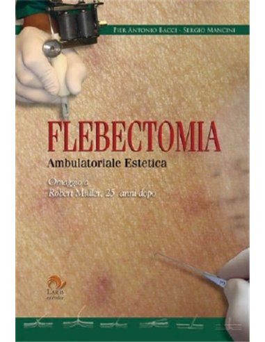 Flebectomia Ambulatoriale ed estetica