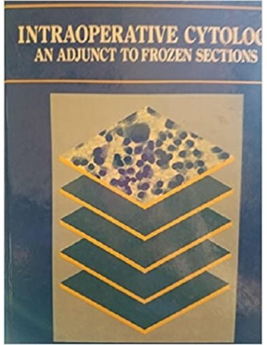 Intraoperative cytology an adjunction to frozen sections