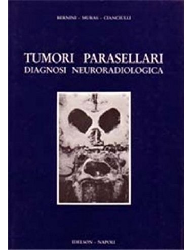 Tumori parasellari diagnosi neuroradiologica