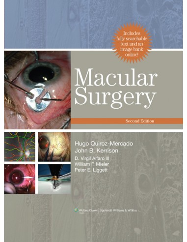 Macular Surgery includes fully...