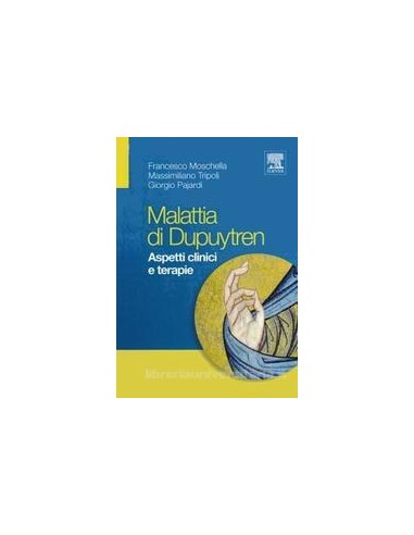 Malattia di Dupuytren (la) 