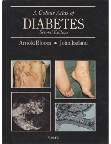Colour atlas of diabetes
