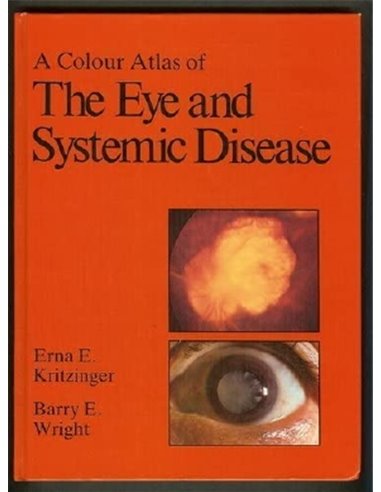 Colour atlas of eye and systemic disease